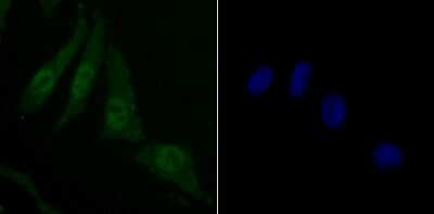 Immunocytochemistry/Immunofluorescence: Skp1 Antibody (JM27-37) [NBP2-67147] - Staining Skp1 in SH-SY5Y cells (green). The nuclear counter stain is DAPI (blue). Cells were fixed in paraformaldehyde, permeabilised with 0.25% Triton X100/PBS.