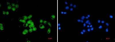 Immunocytochemistry/Immunofluorescence: Skp1 Antibody (S01-6H2) [NBP3-14975] - Immunocytochemistry of Skp1 (green) in MCF-7 using Skp1 antibody at dilution 1/20, and DAPI (blue)