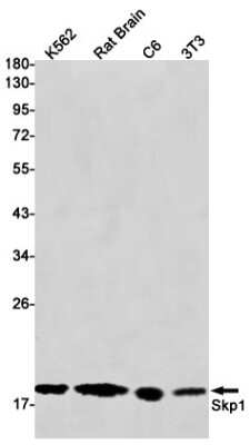 Western Blot: Skp1 Antibody (S01-6H2) [NBP3-14975] - Western blot detection of Skp1 in K562, Rat Brain, C6, 3T3 cell lysates using Skp1 Rabbit mAb (1:1000 diluted). Predicted band size: 19kDa. Observed band size: 19kDa.