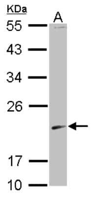 Western Blot: Skp1 Antibody [NBP2-20381] - Sample (30 ug of whole cell lysate) A: 293T 12% SDS PAGE gel, diluted at 1:1000.