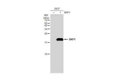 Western Blot: Skp1 Antibody [NBP2-20381] - Non-transfected (-) and transfected (+) 293T whole cell extracts (30 ug) were separated by 15% SDS-PAGE, and the membrane was blotted with SKP1 antibody diluted at 1:500. The HRP-conjugated anti-rabbit IgG antibody was used to detect the primary antibody.