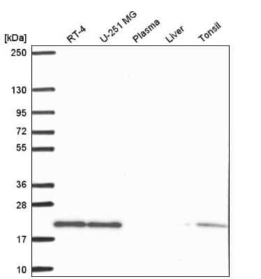 Western Blot: Skp1 Antibody [NBP2-56707] - Western blot analysis in human cell line RT-4, human cell line U-251 MG, human plasma, human liver tissue and human tonsil tissue.