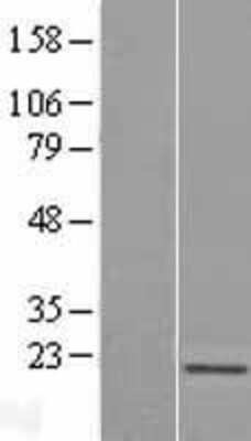 Western Blot: Skp1 Overexpression Lysate (Adult Normal) [NBL1-15994] Left-Empty vector transfected control cell lysate (HEK293 cell lysate); Right -Over-expression Lysate for Skp1.