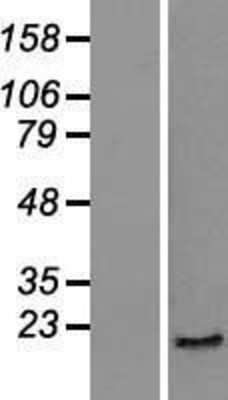 Western Blot: Skp1 Overexpression Lysate (Adult Normal) [NBP2-07556] Left-Empty vector transfected control cell lysate (HEK293 cell lysate); Right -Over-expression Lysate for Skp1.