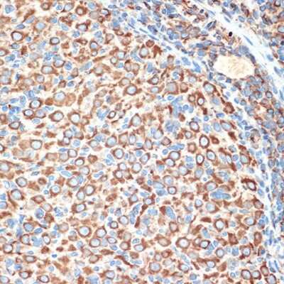 Immunohistochemistry-Paraffin: Slit2 Antibody (1T5A3) [NBP3-16194] - Immunohistochemistry of paraffin-embedded rat ovary using Slit2 Rabbit mAb (NBP3-16194) at dilution of 1:100 (40x lens).Perform microwave antigen retrieval with 10 mM Tris/EDTA buffer pH 9.0 before commencing with IHC staining protocol.