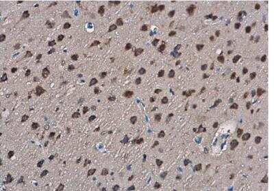 Immunohistochemistry-Paraffin: Slit2 Antibody [NBP2-20398] - Rat brain. SLIT2 antibody  diluted at 1:400. Antigen Retrieval: Citrate buffer, pH 6.0, 15 min.