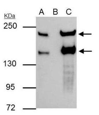 Immunoprecipitation: Slit2 Antibody [NBP2-20398] - Raji whole cell lysate/extract A : 30 ug whole cell lysate/extract of SLIT2 protein expressing Raji cells B : Control with 3 ug of pre-immune rabbit IgG C : Immunoprecipitation of SLIT2 by 3 ug of SLIT2 antibody 5% SDS-PAGE The immunoprecipitated SLIT2 protein was detected by SLIT2 antibody diluted at 1 : 1000. EasyBlot anti-rabbit IgG (HRP) was used as a secondary reagent.