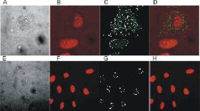 Immunocytochemistry/Immunofluorescence: Smac Antibody (9H10) [NBP1-97590] - Mouse Smac/DIABLO is associated with the mitochondria when overexpressed in human HeLa cells, nuclei are counterstained with propidium iodide (PI).