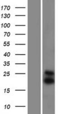 Western Blot: Smac Overexpression Lysate (Adult Normal) [NBP2-11272] Left-Empty vector transfected control cell lysate (HEK293 cell lysate); Right -Over-expression Lysate for Smac.