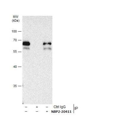 Immunoprecipitation: Smad3 Antibody [NBP2-20411] - HeLa whole cell extracts using 2 ug of SMAD2 / SMAD3 antibody. Western blot analysis was performed using SMAD2 / SMAD3 antibody. EasyBlot HRP-conjugated anti rabbit IgG antibody was used to detect the primary antibody.