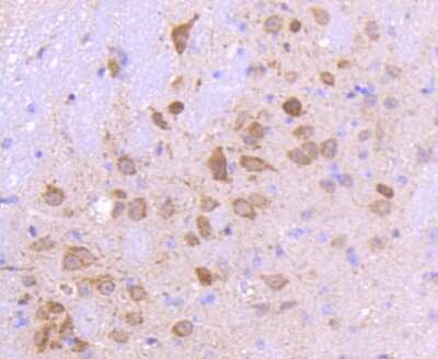 Immunohistochemistry-Paraffin: Smad3 Antibody (SY25-01) [NBP2-67434] - Analysis of paraffin-embedded mouse brain tissue using anti-Smad3 antibody. Counter stained with hematoxylin.