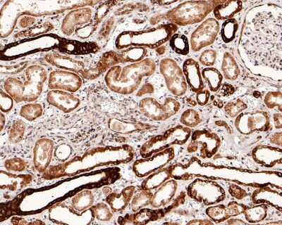 Immunohistochemistry-Paraffin: Smad3 Antibody (SY25-01) [NBP2-67434] - Analysis of paraffin-embedded human kidney tissue with Rabbit anti-Smad3 antibody washed with ddH2O and PBS, and then probed with the primary antibody  at 1/500 dilution for 1 hour at room temperature. The detection was performed using an HRP conjugated compact polymer system. DAB was used as the chromogen. Tissues were counterstained with hematoxylin and mounted with DPX.