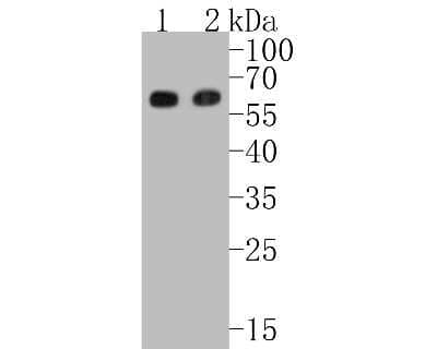 Western Blot: Smad3 Antibody (SY25-01) [NBP2-67434] - Western blot analysis of Smad3 on different lysates. Proteins were transferred to a PVDF membrane and blocked with 5% BSA in PBS for 1 hour at room temperature. The primary antibody (1/500) was used in 5% BSA at room temperature for 2 hours. Goat Anti-Rab