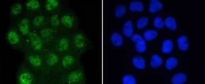 Immunocytochemistry/Immunofluorescence: Smad3 [p Ser423, p Ser425] Antibody (ST0493) [NBP2-67513] - Staining Phospho-Smad3(S423/S425) in A431 cells (green). The nuclear counter stain is DAPI (blue). Cells were fixed in paraformaldehyde, permeabilised with 0.25% Triton X100/PBS.