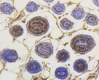 Immunohistochemistry-Paraffin: Smad3 [p Ser423, p Ser425] Antibody (ST0493) [NBP2-67513] - Analysis of paraffin-embedded mouse skin tissue using anti-Phospho-Smad3(S423/S425) antibody. Counter stained with hematoxylin.