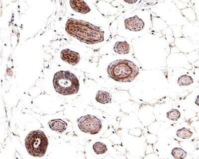 Immunohistochemistry-Paraffin: Smad3 [p Ser423, p Ser425] Antibody (ST0493) [NBP2-67513] - Analysis of paraffin-embedded mouse skin tissue with Rabbit anti-Smad3 [p Ser423, p Ser425] antibody washed with ddH2O and PBS, and then probed with the primary antibody  at 1/500 dilution for 1 hour at room temperature. The detection was performed using an HRP conjugated compact polymer system. DAB was used as the chromogen. Tissues were counterstained with hematoxylin and mounted with DPX.