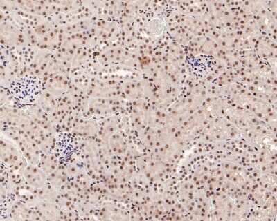 Immunohistochemistry-Paraffin: Smad3 [p Ser423, p Ser425] Antibody (ST0493) [NBP2-67513] - Analysis of paraffin-embedded mouse kidney tissue with Rabbit anti-Phospho-Smad3 [p Ser423, p Ser425) antibody washed with ddH2O and PBS, and then probed with the primary antibody  at 1/500 dilution for 1 hour at room temperature. The detection was performed using an HRP conjugated compact polymer system. DAB was used as the chromogen. Tissues were counterstained with hematoxylin and mounted with DPX.