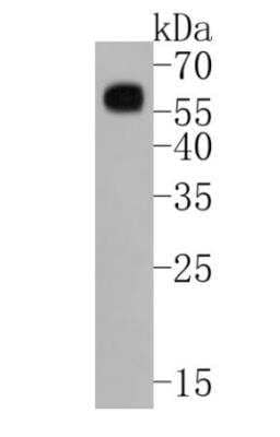 Western Blot: Smad3 [p Ser423, p Ser425] Antibody (ST0493) [NBP2-67513] - Analysis of Phospho-Smad3(S423/S425) on K562 cell lysates. Proteins were transferred to a PVDF membrane and blocked with 5% BSA in PBS for 1 hour at room temperature. The primary antibody ( 1/500) was used in 5% BSA at room temperature for 2 hours. Goat Anti-Rabbit IgG - HRP Secondary Antibody  at 1:5,000 dilution was used for 1 hour at room temperature.