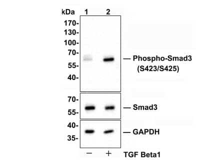 Western Blot: Smad3 [p Ser423, p Ser425] Antibody (ST0493) [NBP2-67513] - Analysis of Smad3 [p Ser423, p Ser425] on A549 cell lysates. Lane 1 : A549 cells, whole cell lysate, 10 ug /lane. Lane 2 : A549 cells were treated with 5 ng/ml TGF beta1 for 24 hours, whole cell lysates, 10 ug/lane. Proteins were transferred to a PVDF membrane and blocked with 5% BSA in PBS for 1 hour at room temperature. The primary antibody Anti-Smad3 [p Ser423, p Ser425] (1/500) , Anti-Smad3 antibody (1/500) and Anti-GAPDH antibody (1/10,000)was used in 5% BSA at room temperature for 2 hours. Goat Anti-Rabbit IgG H&L (HRP) Secondary Antibody at 1:200,000 dilution was used for 1 hour at room temperature. Predicted band size: 48 kDa Observed band size: 60 kDa Exposure time: 3 seconds