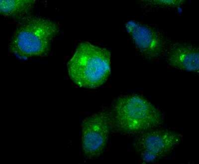 Immunocytochemistry/Immunofluorescence: Smad4 Antibody [NBP2-89144] - Staining Smad4 in A549 cells (green). The nuclear counter stain is DAPI (blue). Cells were fixed in paraformaldehyde, permeabilised with 0.25% Triton X100/PBS.