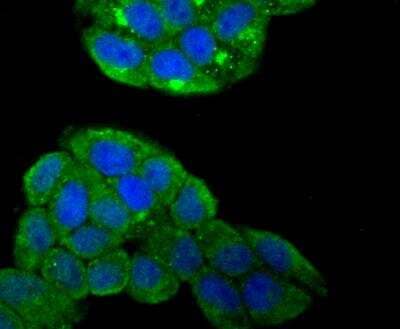 Immunocytochemistry/Immunofluorescence: Smad4 Antibody [NBP2-89144] - Staining Smad4 in Hela cells (green). The nuclear counter stain is DAPI (blue). Cells were fixed in paraformaldehyde, permeabilised with 0.25% Triton X100/PBS.