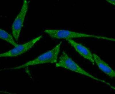 Immunocytochemistry/Immunofluorescence: Smad4 Antibody [NBP2-89144] - Staining Smad4 in SH-SY5Y cells (green). The nuclear counter stain is DAPI (blue). Cells were fixed in paraformaldehyde, permeabilised with 0.25% Triton X100/PBS.