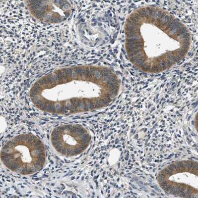 Immunohistochemistry-Paraffin: Smad4 Antibody [NBP1-84992] - Staining of human endometrium shows strong cytoplasmic positivity in glandular cells.