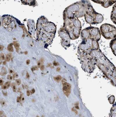 Immunohistochemistry-Paraffin: Smad4 Antibody [NBP1-84992] - Staining of human placenta shows moderate to strong cytoplasmic and nuclear positivity in trophoblastic and decidual cells.