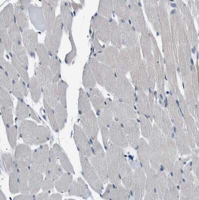 Immunohistochemistry-Paraffin: Smad4 Antibody [NBP1-84992] - Staining of human skeletal muscle shows no positivity in myocytes as expected.