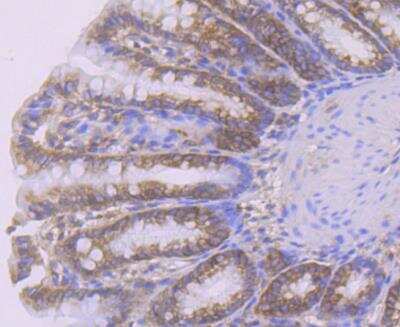 Immunohistochemistry-Paraffin: Smad4 Antibody [NBP2-89144] - Analysis of paraffin-embedded rat large intestine tissue using anti-Smad4 antibody. Counter stained with hematoxylin.
