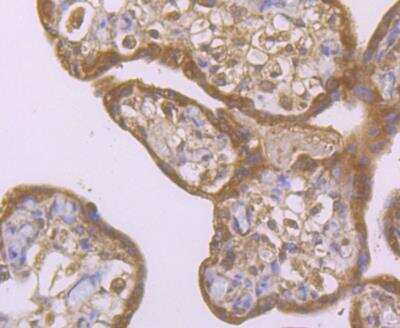 Immunohistochemistry-Paraffin: Smad4 Antibody [NBP2-89144] - Analysis of paraffin-embedded human placenta tissue using anti-Smad4 antibody. Counter stained with hematoxylin.