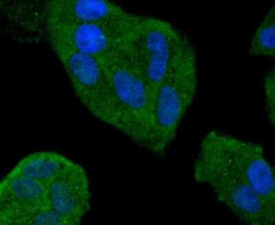Immunocytochemistry/Immunofluorescence: Smad4 Antibody (SP05-05) [NBP2-67372] - Staining Smad4 in Hela cells (green). The nuclear counter stain is DAPI (blue). Cells were fixed in paraformaldehyde, permeabilised with 0.25% Triton X100/PBS.