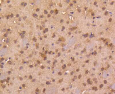 Immunohistochemistry-Paraffin: Smad4 Antibody (SP05-05) [NBP2-67372] - Analysis of paraffin-embedded mouse brain tissue using anti-Smad4 antibody. Counter stained with hematoxylin.