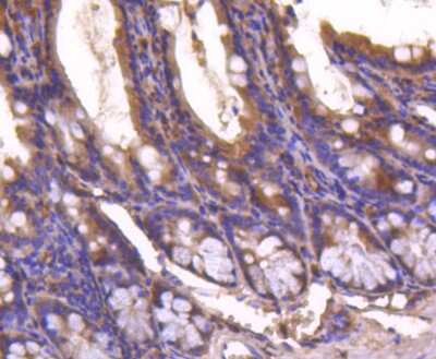 Immunohistochemistry-Paraffin: Smad4 Antibody (SP05-05) [NBP2-67372] - Analysis of paraffin-embedded mouse colon tissue using anti-Smad4 antibody. Counter stained with hematoxylin.