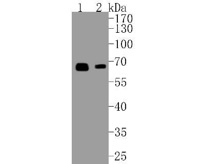 Western Blot: Smad4 Antibody (SP05-05) [NBP2-67372] - Western blot analysis of Smad4 on different lysates. Proteins were transferred to a PVDF membrane and blocked with 5% BSA in PBS for 1 hour at room temperature. The primary antibody (1/500) was used in 5% BSA at room temperature for 2 hours. Goat Anti-Rab