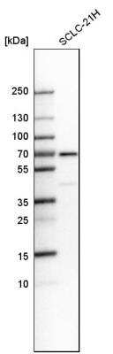 Western Blot: Smad4 Antibody [NBP1-84992] - Western blot analysis in human cell line SCLC-21H.