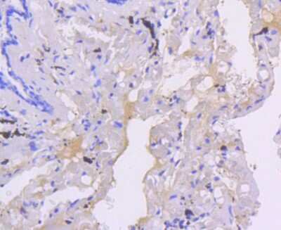 Immunohistochemistry-Paraffin: Smad5 Antibody (SI17-06) [NBP2-67404] - Analysis of paraffin-embedded human lung tissue using anti-Smad5 antibody. Counter stained with hematoxylin.