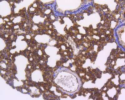 Immunohistochemistry-Paraffin: Smad5 Antibody (SI17-06) [NBP2-67404] - Immunohistochemical analysis of paraffin-embedded mouse lung tissue using anti-Smad5 antibody. The section was pre-treated using heat mediated antigen retrieval with Tris-EDTA buffer (pH 8.0-8.4) for 20 minutes. The tissues were blocked in 5% BSA for 30 minutes at room temperature, washed with ddH2O and PBS, and then probed with the primary antibody (ET1606-26, 1/50) for 30 minutes at room temperature. The detection was performed using an HRP conjugated compact polymer system. DAB was used as the chromogen. Tissues were counterstained with hematoxylin and mounted with DPX.