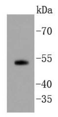 Western Blot: Smad5 Antibody (SI17-06) [NBP2-67404] - Analysis of Smad5 on PC-3M cell lysates using anti-Smad5 antibody at 1/1,000 dilution.