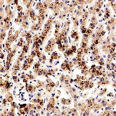 Immunohistochemistry-Paraffin: Smad7 Antibody - Azide Free [NB100-56688] - IHC analysis of a formalin fixed paraffin-embedded (FFPE) human liver using Smad7 antibody on a Bond Rx autostainer (Leica Biosystems). The assay involved 20 minutes of heat induced antigen retrieval (HIER) using 10mM sodium citrate buffer (pH 6.0) and endogenous peroxidase quenching with peroxide block. The sections were incubated with primary antibody for 30 minutes and Bond Polymer Refine Detection (Leica Biosystems) with DAB was used for signal development followed by counterstaining with hematoxylin. Whole slide scanning and capturing of representative images was performed using Aperio AT2 (Leica Biosystems). Cytoplasmic staining of Smad7 was observed. Staining was performed by Histowiz. Image using the standard format of this product.