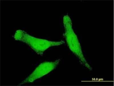 Immunocytochemistry/Immunofluorescence: Smad7 Antibody (3G8) [H00004092-M01] - Analysis of monoclonal antibody to SMAD7 on HeLa cell . Antibody concentration 10 ug/ml.