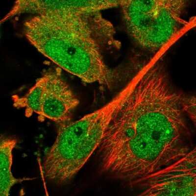 Immunocytochemistry/Immunofluorescence: Smad7 Antibody [NBP1-87728] - Staining of human cell line U-251 MG shows localization to nucleoplasm, nucleoli fibrillar center, cytosol and centrosome. Antibody staining is shown in green.