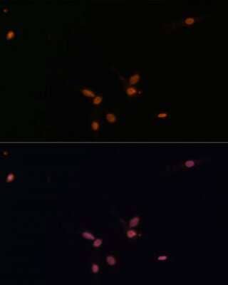 Immunocytochemistry/Immunofluorescence: Smad7 Antibody [NBP2-94047] - Analysis of C6 cells using Smad7 at dilution of 1:100. Blue: DAPI for nuclear staining.