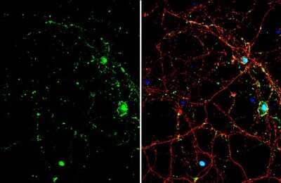 Immunocytochemistry/Immunofluorescence: Smad7 Antibody [NBP3-13375] - Smad7 antibody detects Smad7 protein by immunofluorescent analysis. Sample: DIV9 rat E18 primary cortical neuron cells were fixed in 4% paraformaldehyde at RT for 15 min. Green: Smad7 stained by Smad7 antibody (NBP3-13375) diluted at 1:500. Red: Tau, stained by Tau antibody [GT287] diluted at 1:500. Blue: Fluoroshield with DAPI.