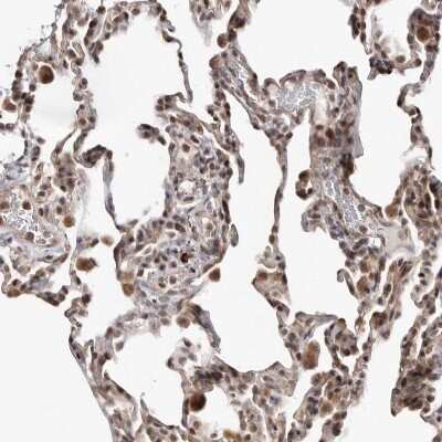 Immunohistochemistry-Paraffin: Smad7 Antibody [NBP1-87728] - Staining of human lung shows nuclear positivity in pneumnocytes and macrophages.