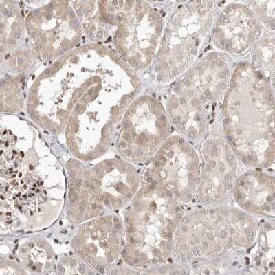 Immunohistochemistry-Paraffin: Smad7 Antibody [NBP1-87728] - Staining of human Kidney shows moderate cytoplasmic positivity in cells in tubules.