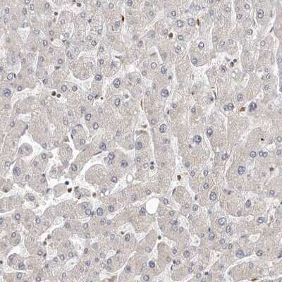 Immunohistochemistry-Paraffin: Smad7 Antibody [NBP1-87728] - Staining of human Liver shows very weak cytoplasmic positivity in hepatocytes.