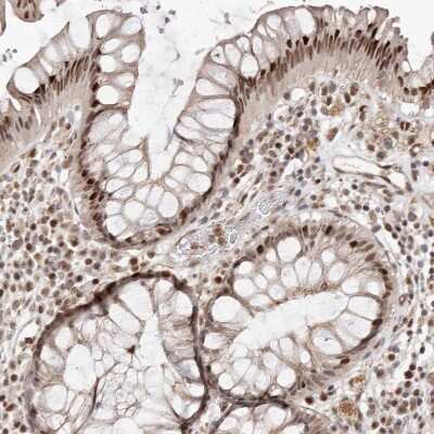 Immunohistochemistry-Paraffin: Smad7 Antibody [NBP1-87728] - Staining of human Rectum shows moderate nuclear and cytoplasmic positivity in glandular cells.