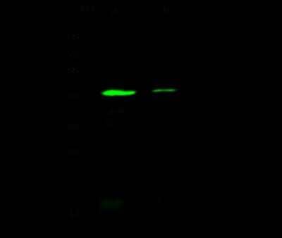 Western Blot: Smad7 Antibody [NBP2-99045] - Anti-Smad7 rabbit polyclonal antibody at 1:500 dilution. Lane A: HeLa Whole Cell Lysate. Lane B: A431 Whole Cell Lysate. Lysates/proteins at 30 ug per lane. Secondary Goat Anti- Rabbit  IgG H&L (Dylight 800)  at 1/10000 dilution. Developed using the Odyssey technique. Performed under reducing conditions. Predicted band size: 46 kDa. Observed band size: 43 kDa