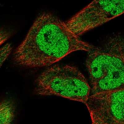 Immunocytochemistry/Immunofluorescence: Smad9 Antibody [NBP2-38176] - Immunofluorescent staining of human cell line RH-30 shows localization to nucleoplasm & cytosol.